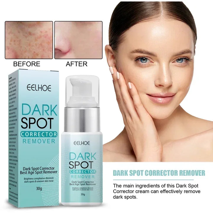 BrightenUp Spotless Skin Cream